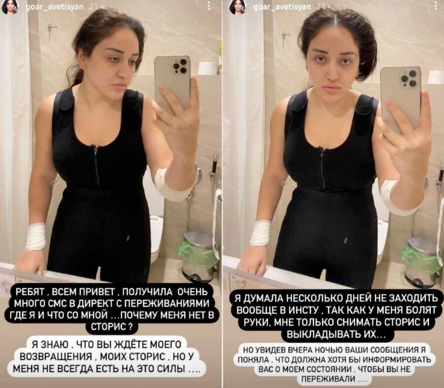 Знаменитости, у которых начали гнить импланты, начался сепсис и осложнения после пластики Знаменитости, у которых начали гнить импланты, начался сепсис и осложнения после пластики