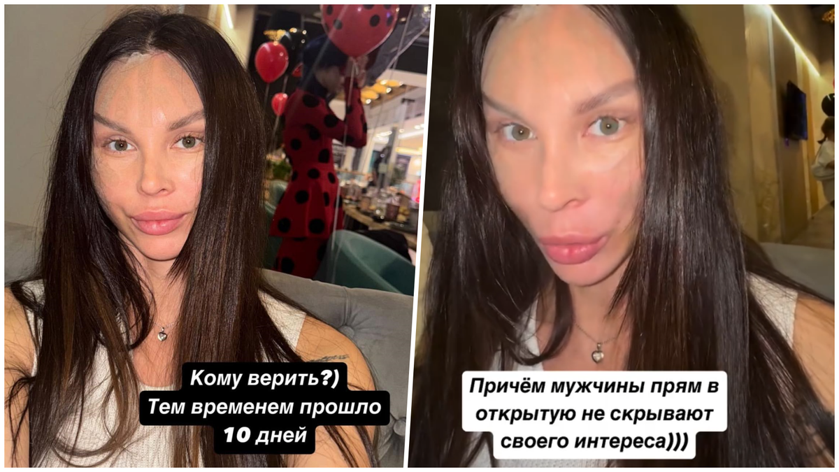Когда красота становится абсурдом. Звезды и их пластические операции Когда красота становится абсурдом. Звезды и их пластические операции