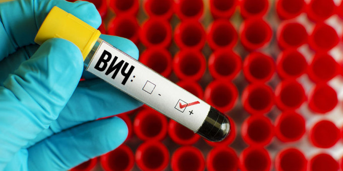 10 знаменитостей, которые живут с подтверждённым ВИЧ и не стыдятся в этом признаться 10 знаменитостей, которые живут с подтверждённым ВИЧ и не стыдятся в этом признаться